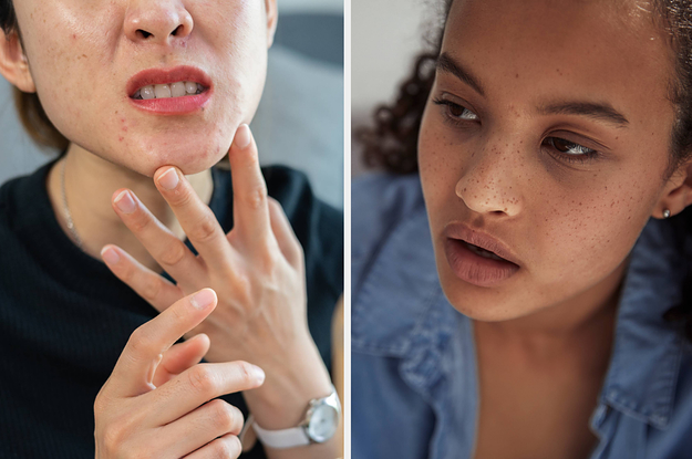 A woman looks at her acne in the mirror vs a woman looks over at something shocked