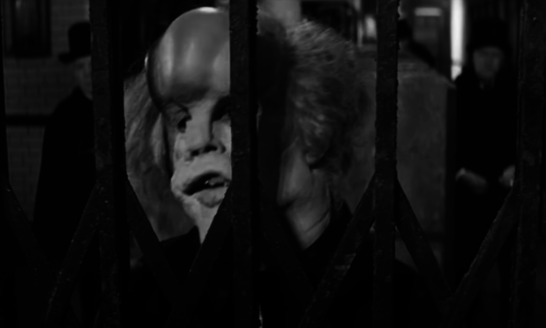 Screenshot from &quot;The Elephant Man&quot;