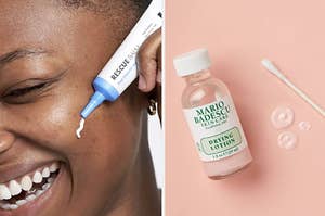 a hero rescue balm and a mario badescu drying lotion