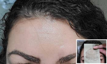 Reviewer's forehead with oily skin and using the blotting sheet