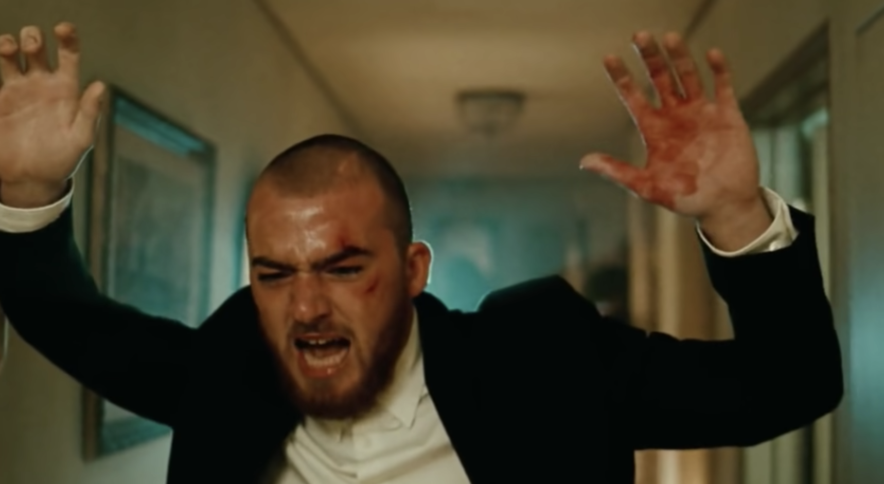 Close-up of Angus in a scene from Euphoria with his hands, one bloody, raised and looking very agitated
