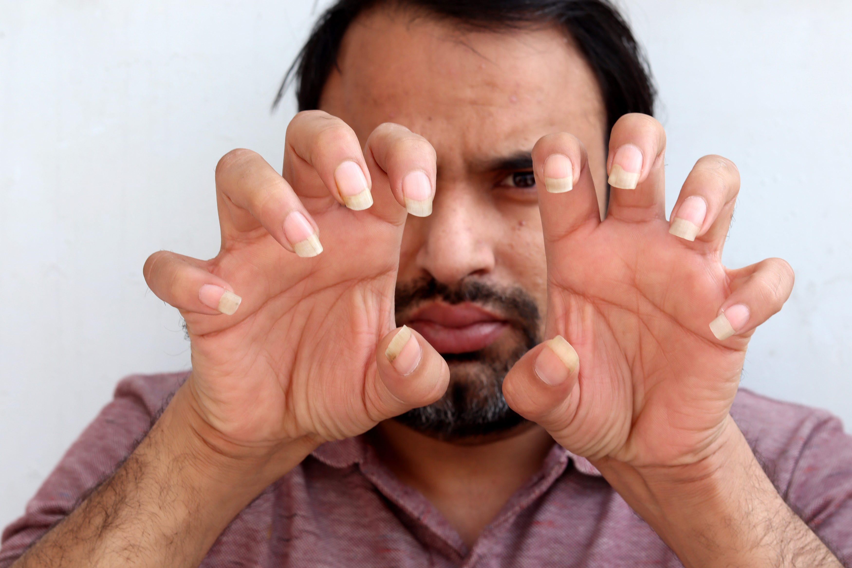 A man showing his long fingernails