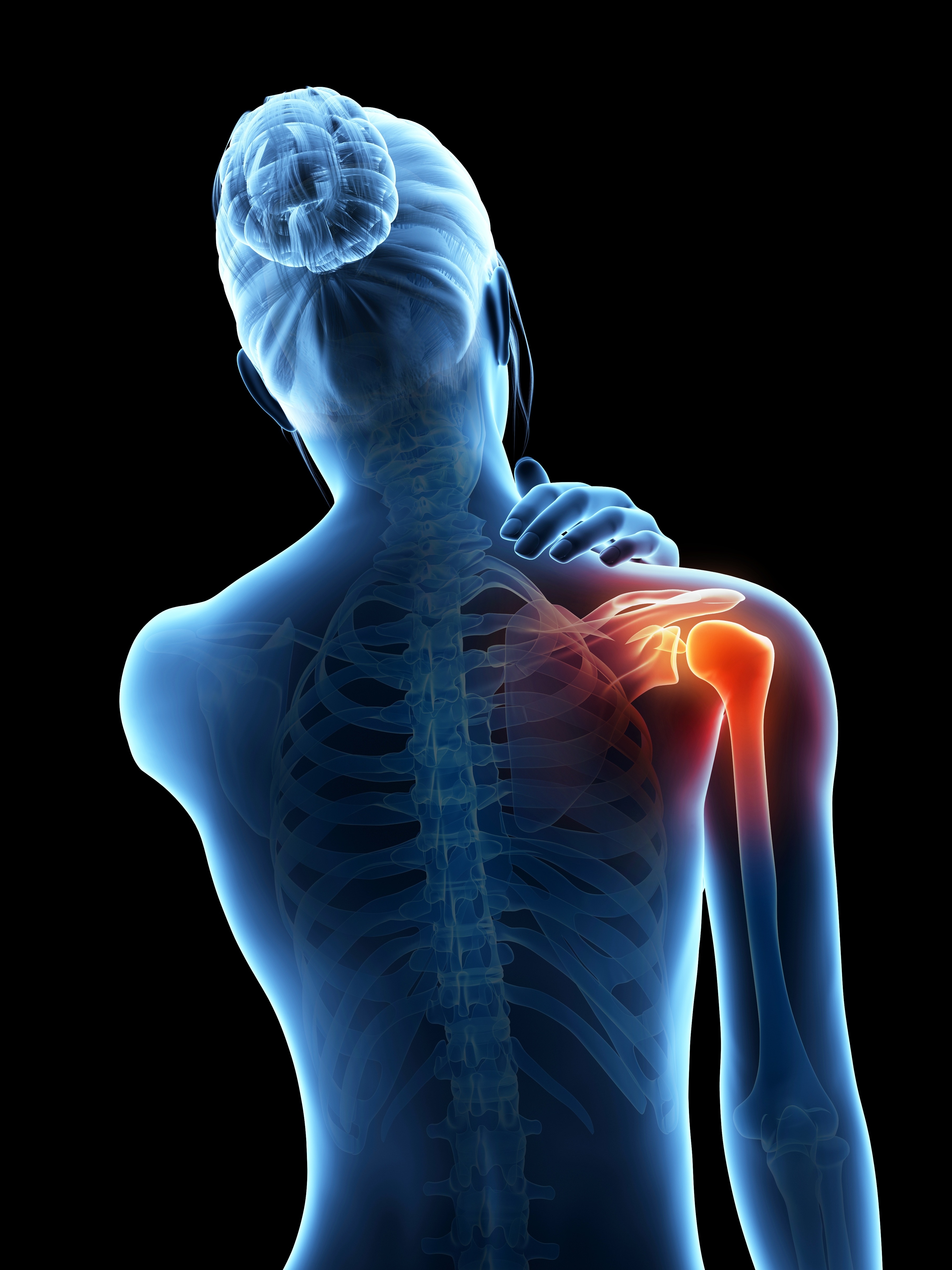 diagram of a womans body showing pain and inflammation in the shoulder joint