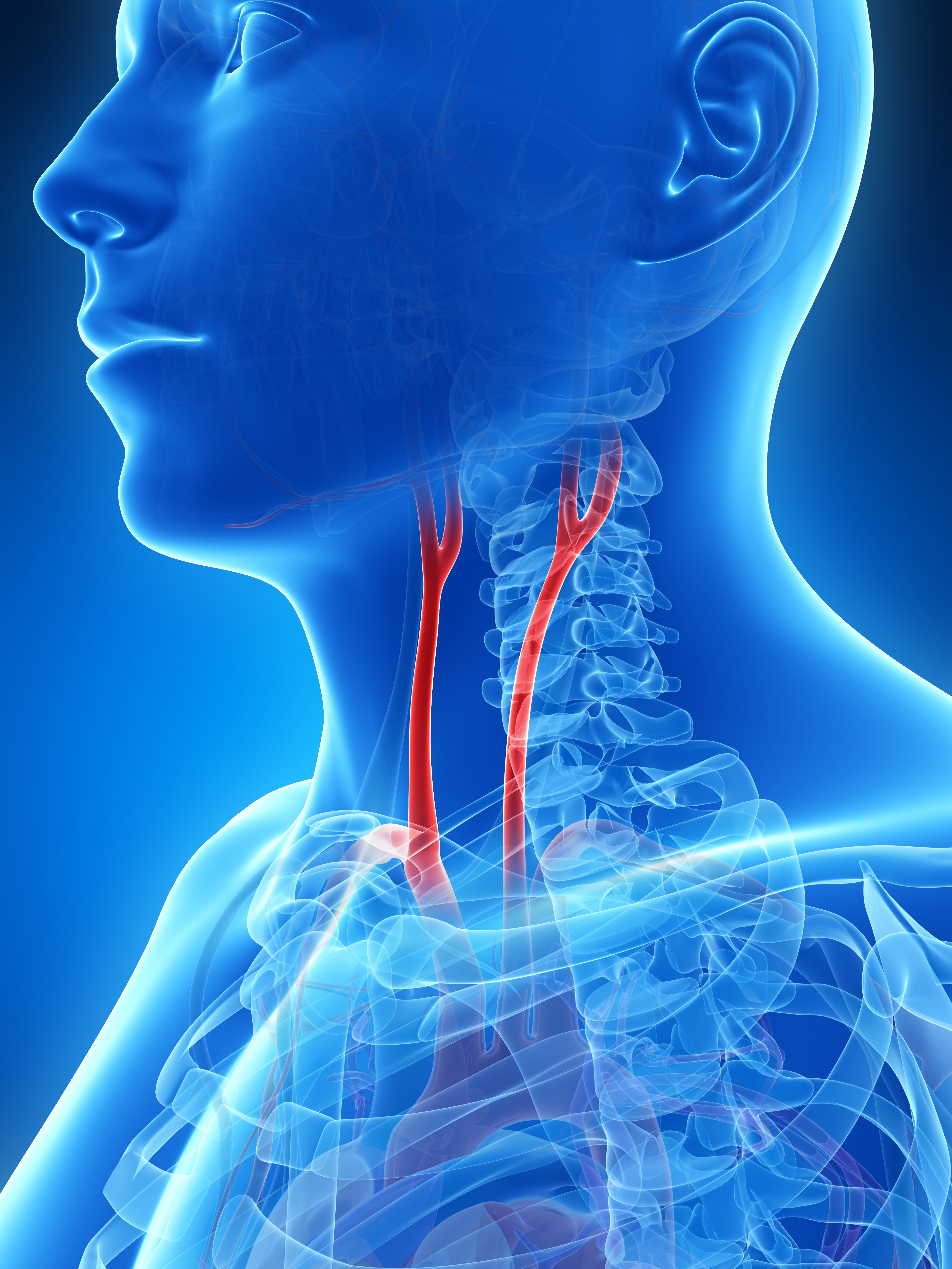 Medical illustration showing the carotid arteries running up the neck