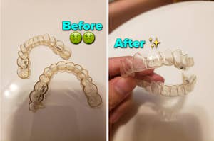 reviewers retainer before using cleaner then after with stains gone