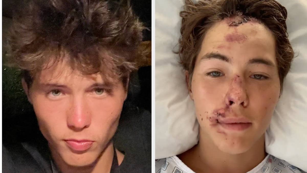 The influencer, who documents his time living in Hawaii, is expected to make a long road to recovery. His family has set up a GoFundMe for his medical expensive.