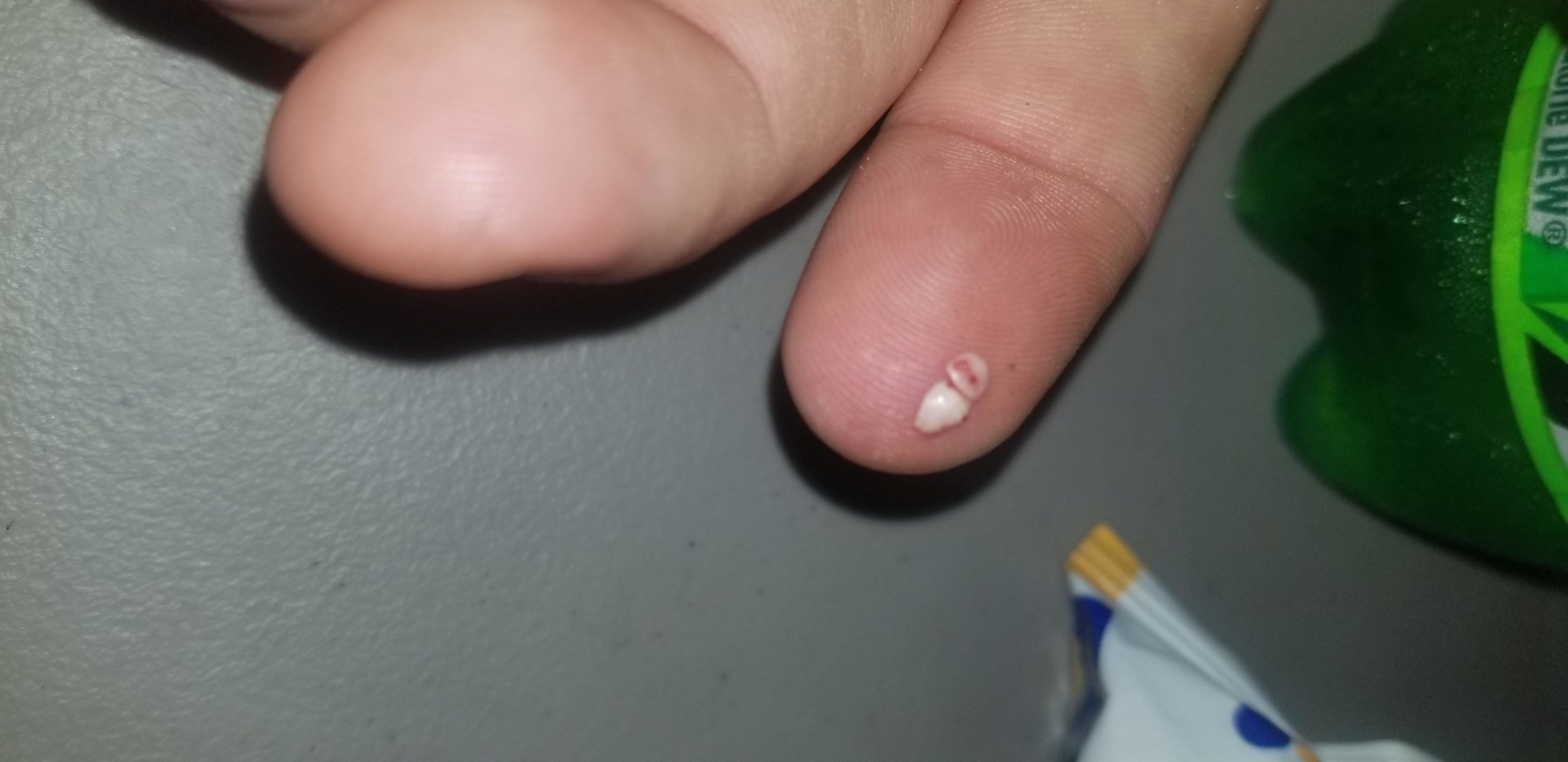A tiny tooth on a finger