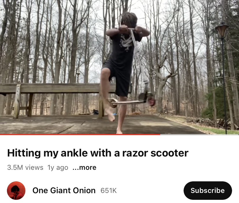 &quot;Hitting my ankle with a razor scooter&quot;