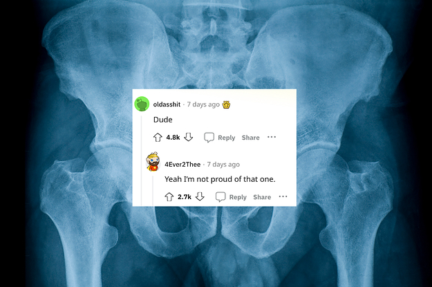An X-ray of an abdomen with a reddit comment that just says "dude" over it