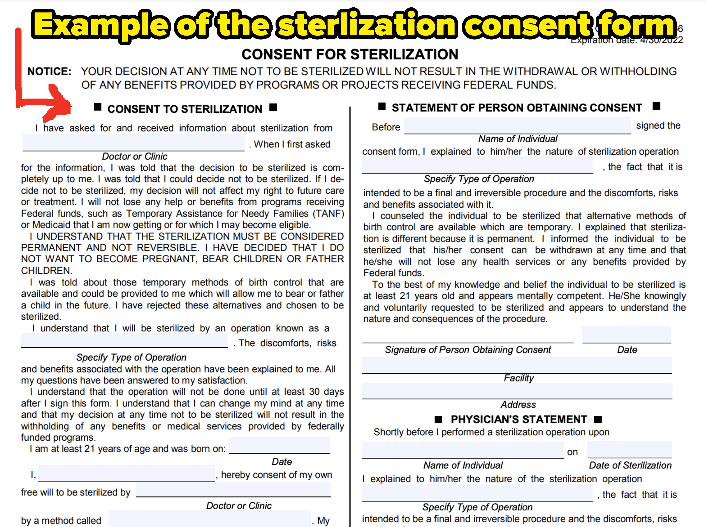 Example of a sterilization consent form rom 2022