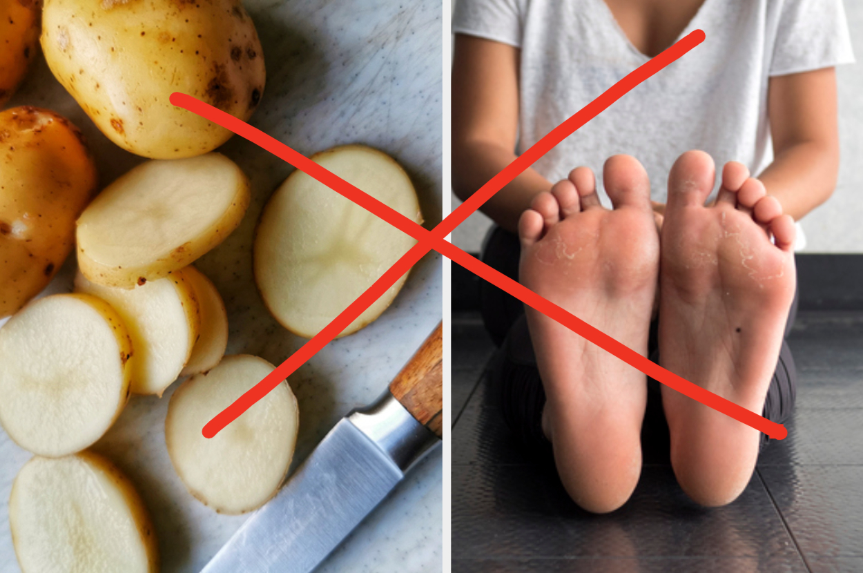 Sliced potatoes and feet