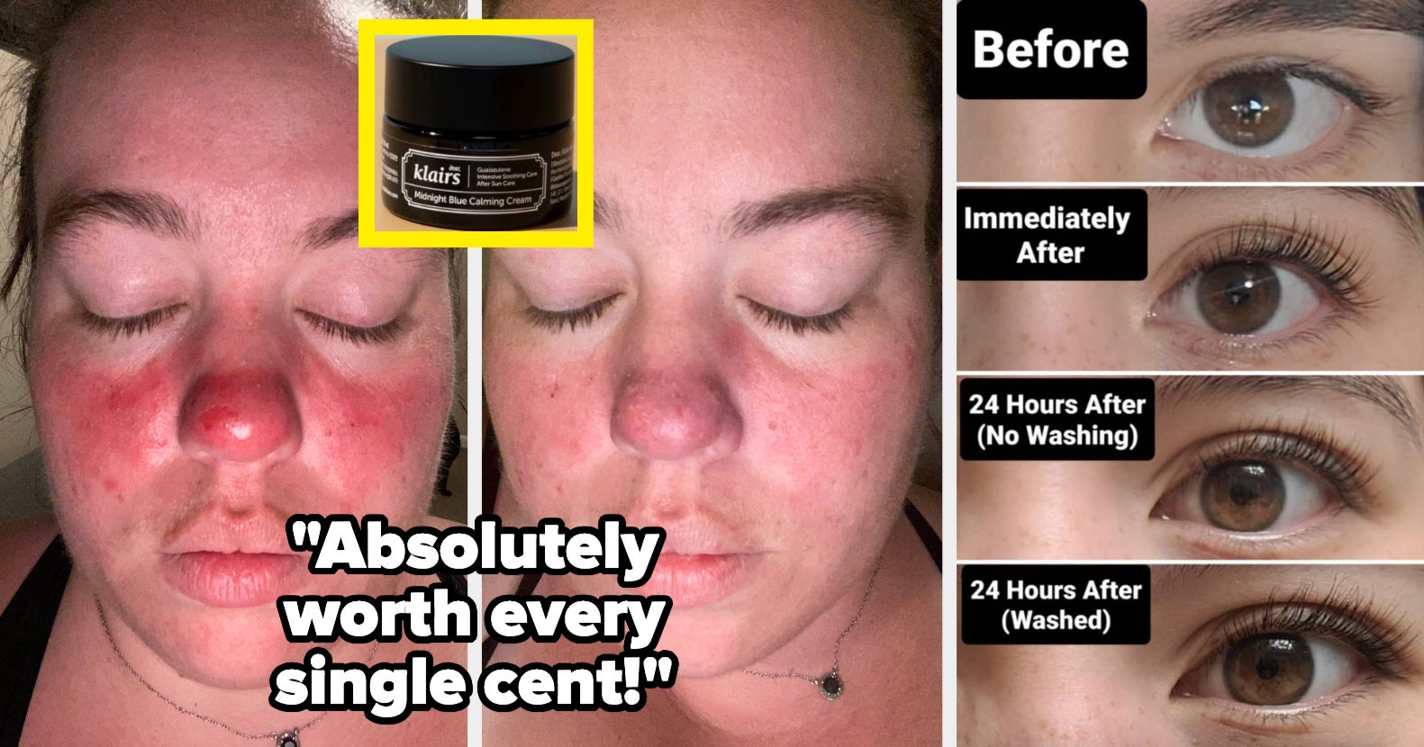 Jaw Dropping Dermaplaning Before After Pictures Will Leave You Speechless - w3cxqhk