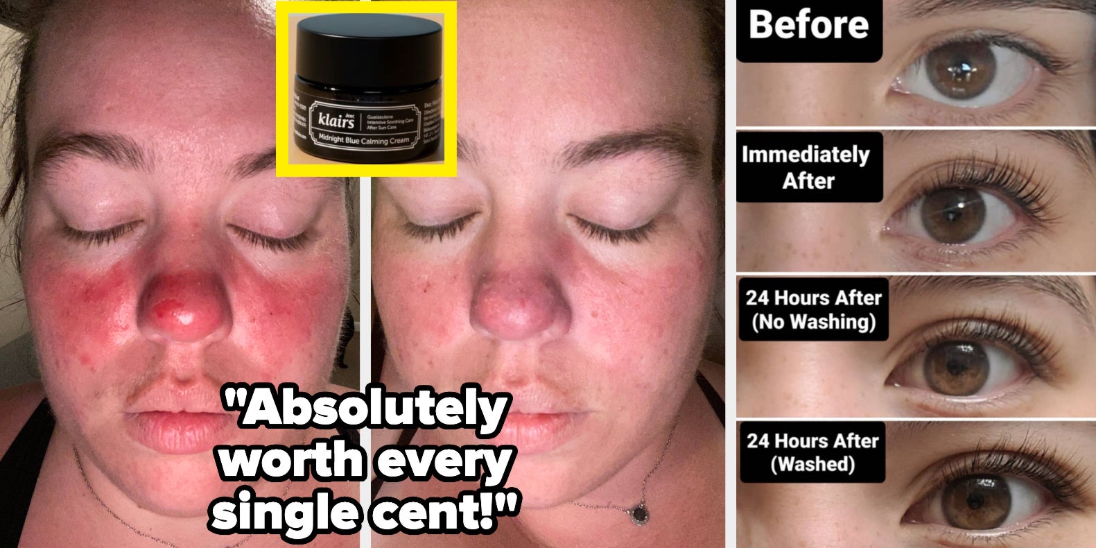 31 Beauty Products With Jaw Dropping Before And Afters - Vimarsana News