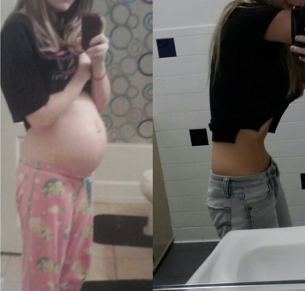 Selfies showing a pregnant belly and a very flat one