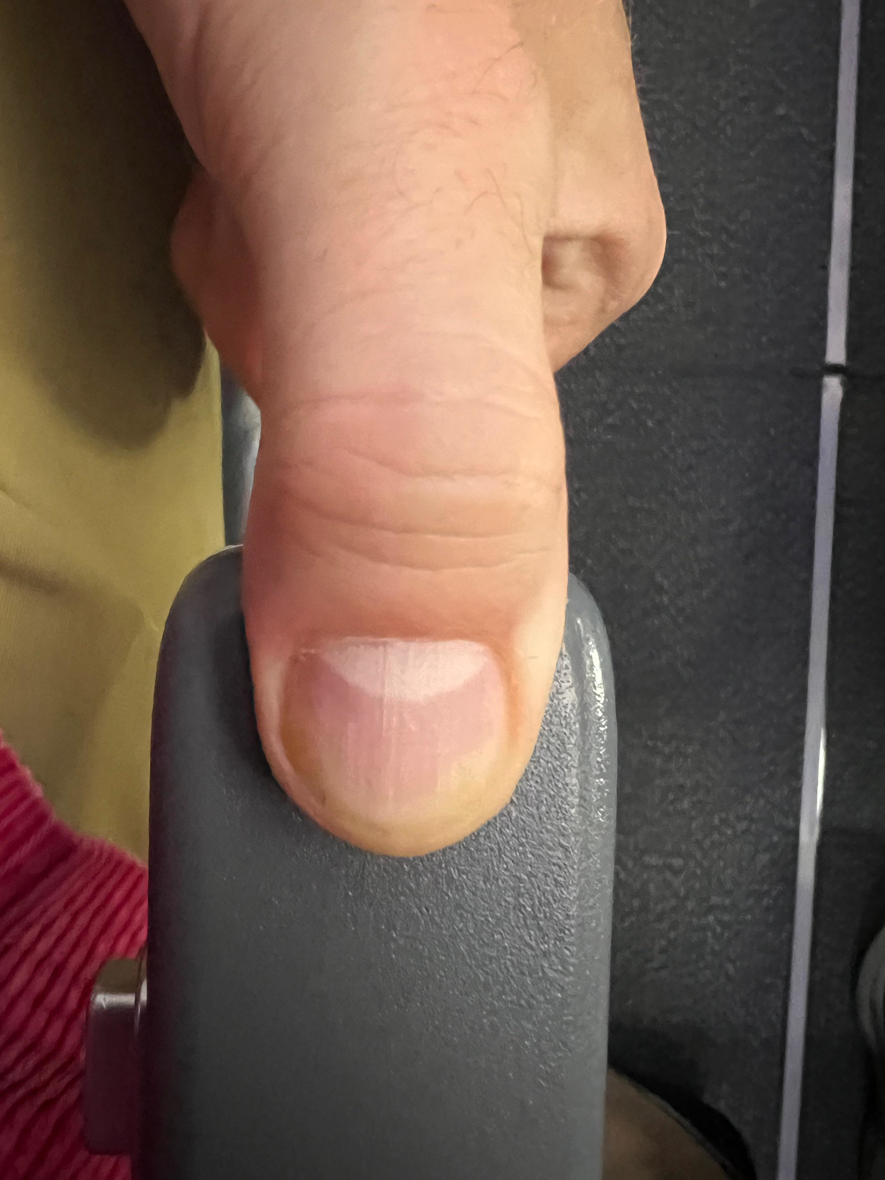 A thumb on an armrest