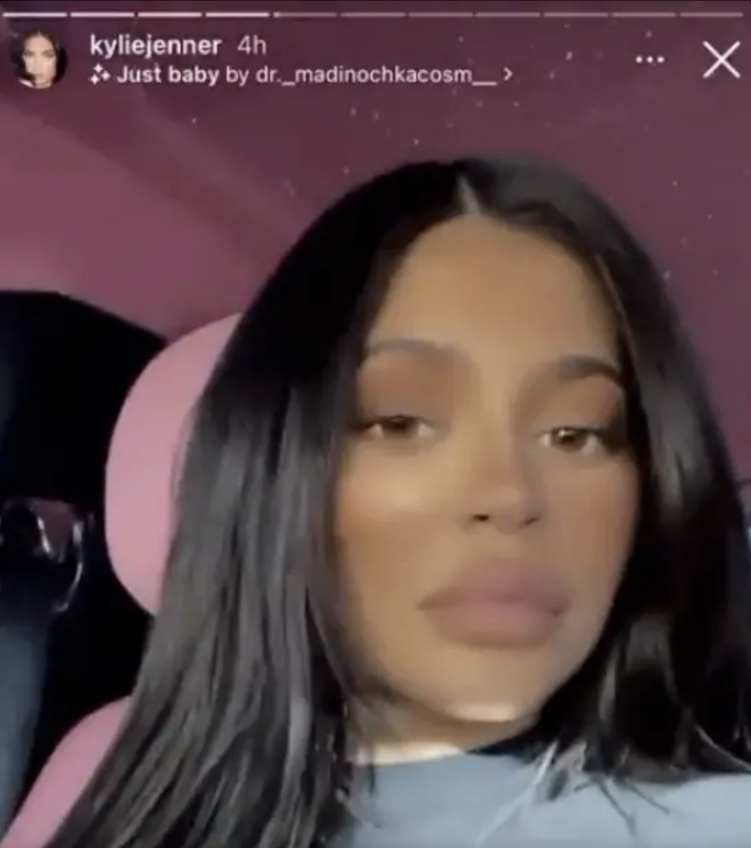 Screenshot of Kyle from her IG story with seemingly darker skin