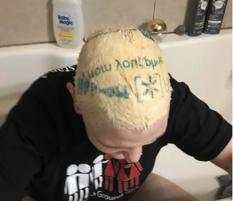 A person sitting in a bathtub with bleached hair and the blue remnants of a Walmart plastic bag patterned in their hair