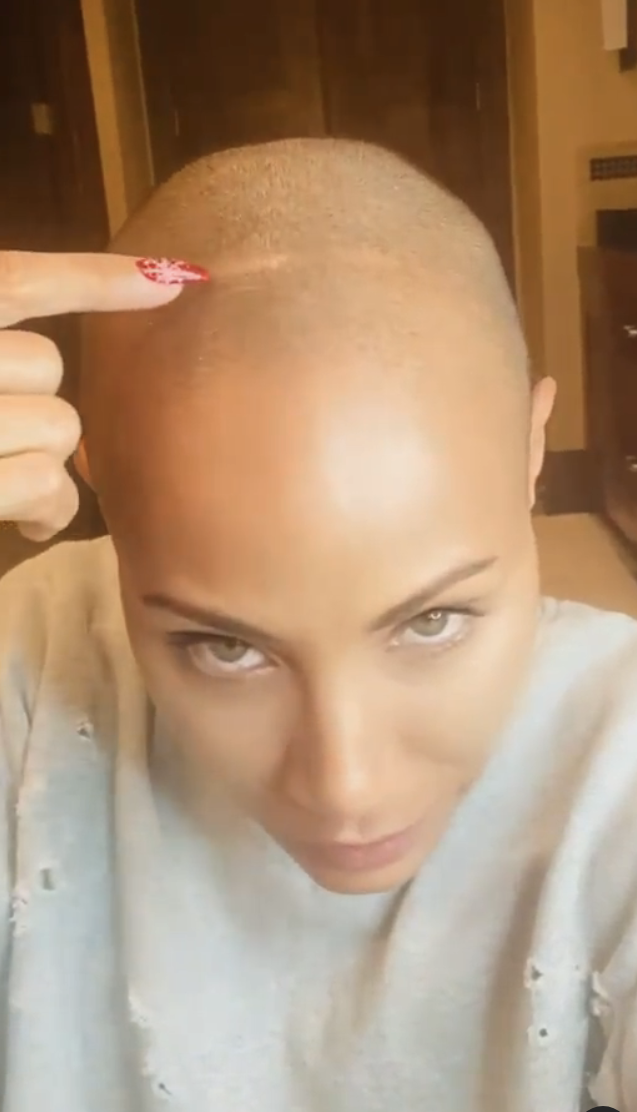 Close-up of Jada pointing at the line on her head