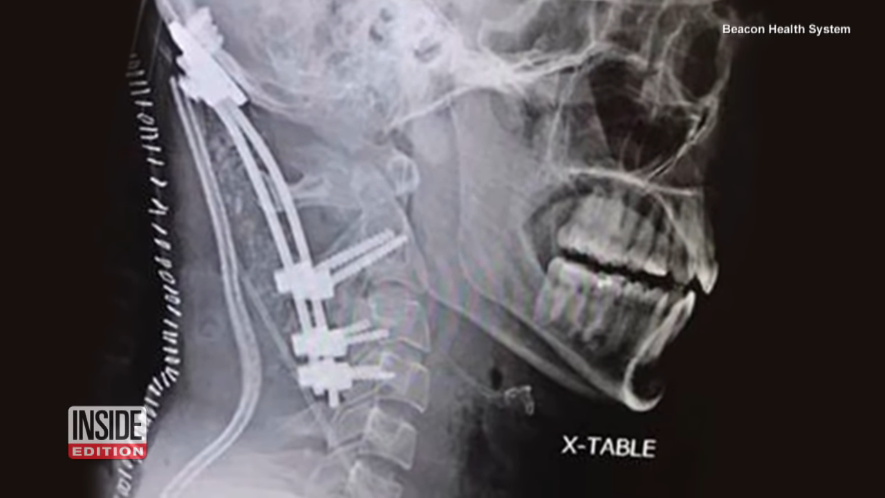 An X-ray of a head