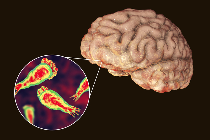 A brain-eating amoeba