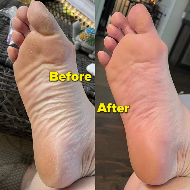 split image of reviewers foot before and after using soak