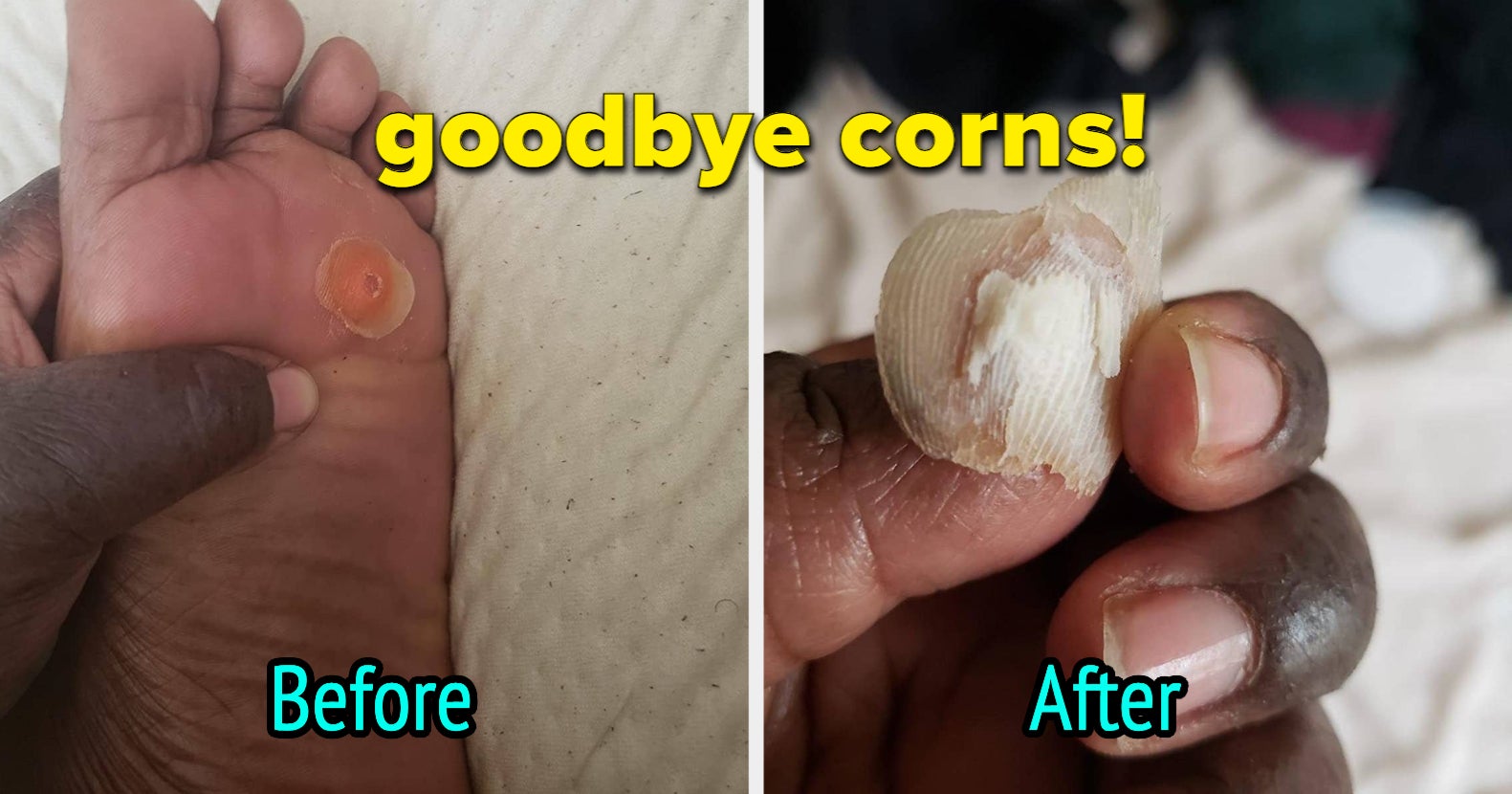 This $8 Pedicure Rasp Will Give You Disgustingly Satisfying Results, And  Super Smooth Feet