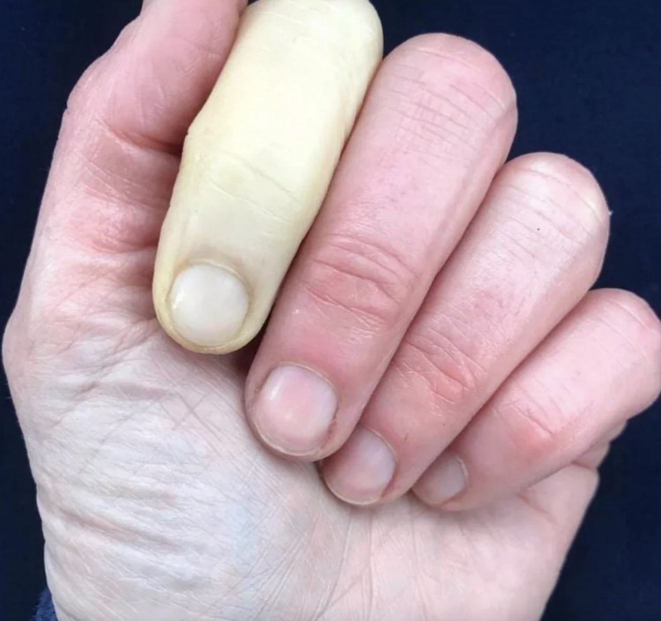 A very pale pointy finger and reddish-white other fingers on a hand