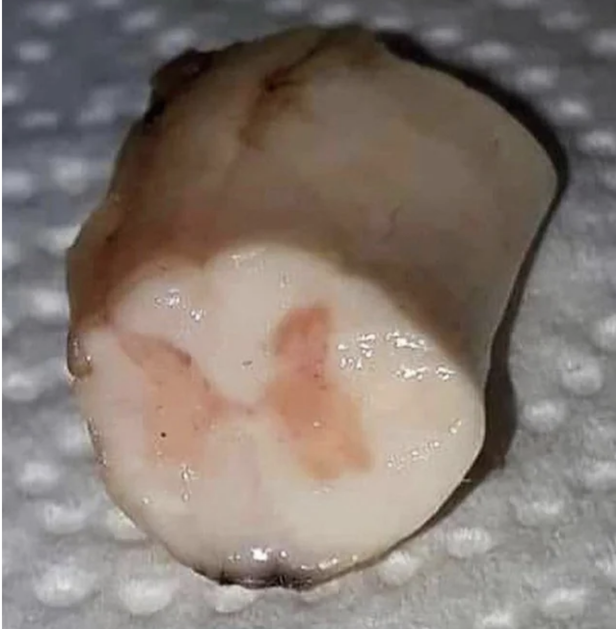 A spinal cord&#x27;s milky-looking, moist interior