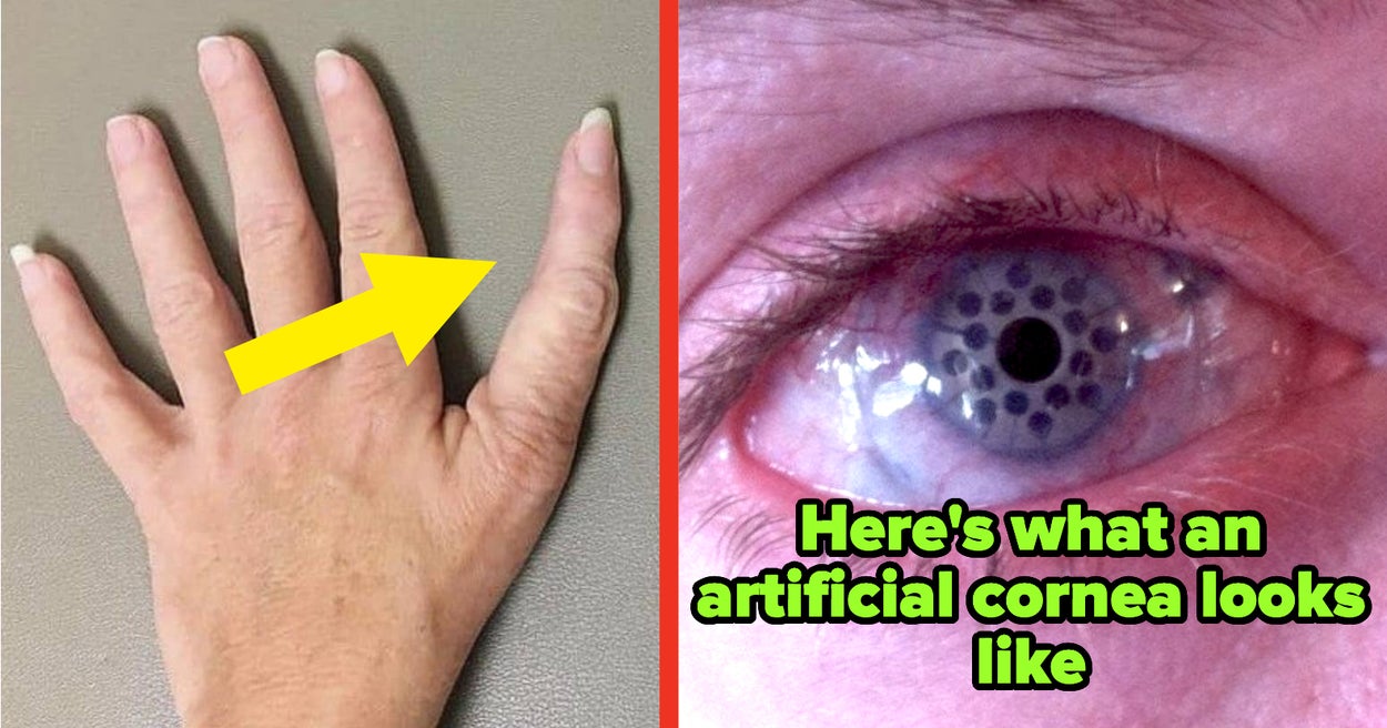34 Absolutely Wild Photos of the Human Body That Made Me Look at My Computer in Shock