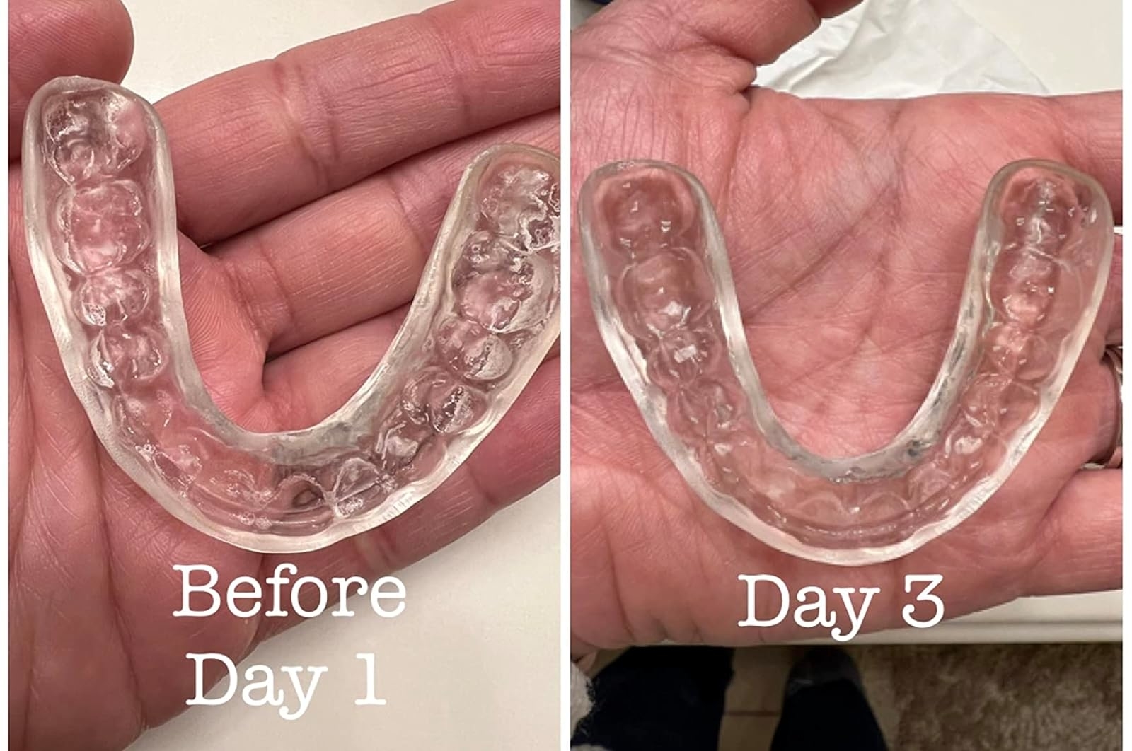 Reviewer&#x27;s photo of a retainer before and after using the retainer cleaning tablets