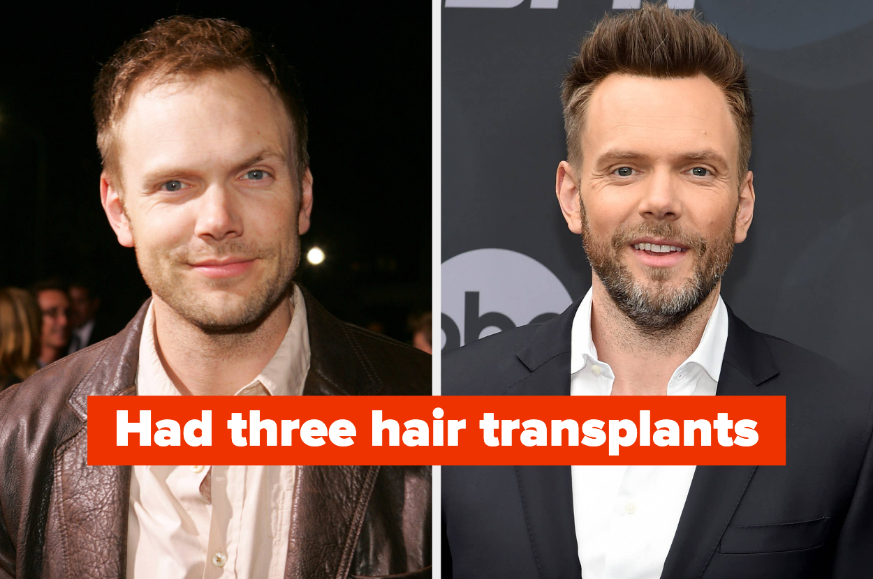 Celebs with fake hair