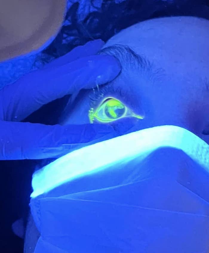 a person with a glow-in-the-dark eye