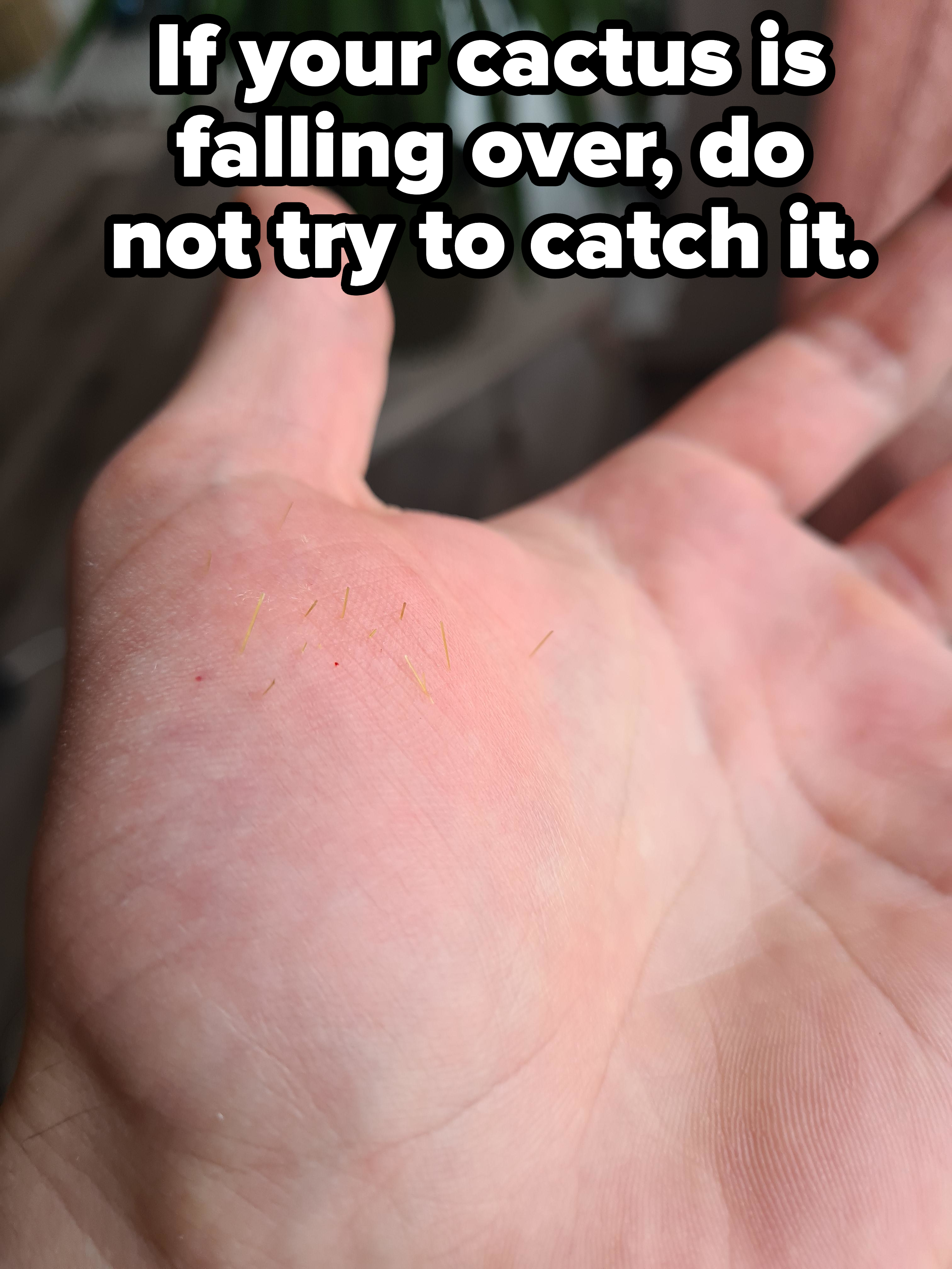 Close-up of the palm of a hand with little needles emerging from it, with caption, &quot;If your cactus is falling over, do not try to catch it&quot;