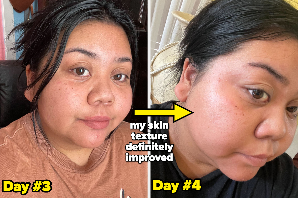 The author is showing her skin after day three and day four of using rice water, saying that her skin texture definitely improved
