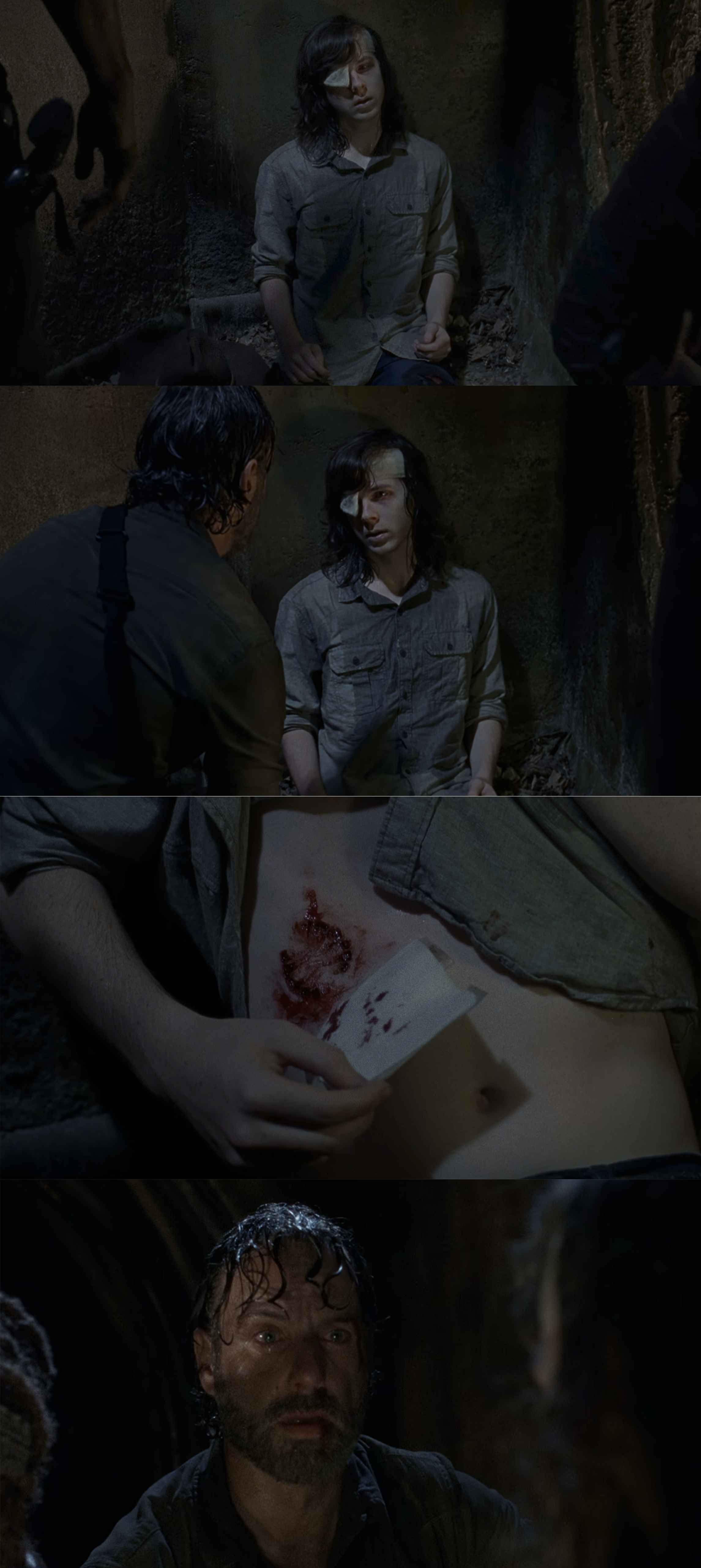 carl showing his bite wound on his stomach
