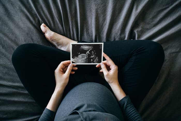 pregnant woman holding an ultrasound photo