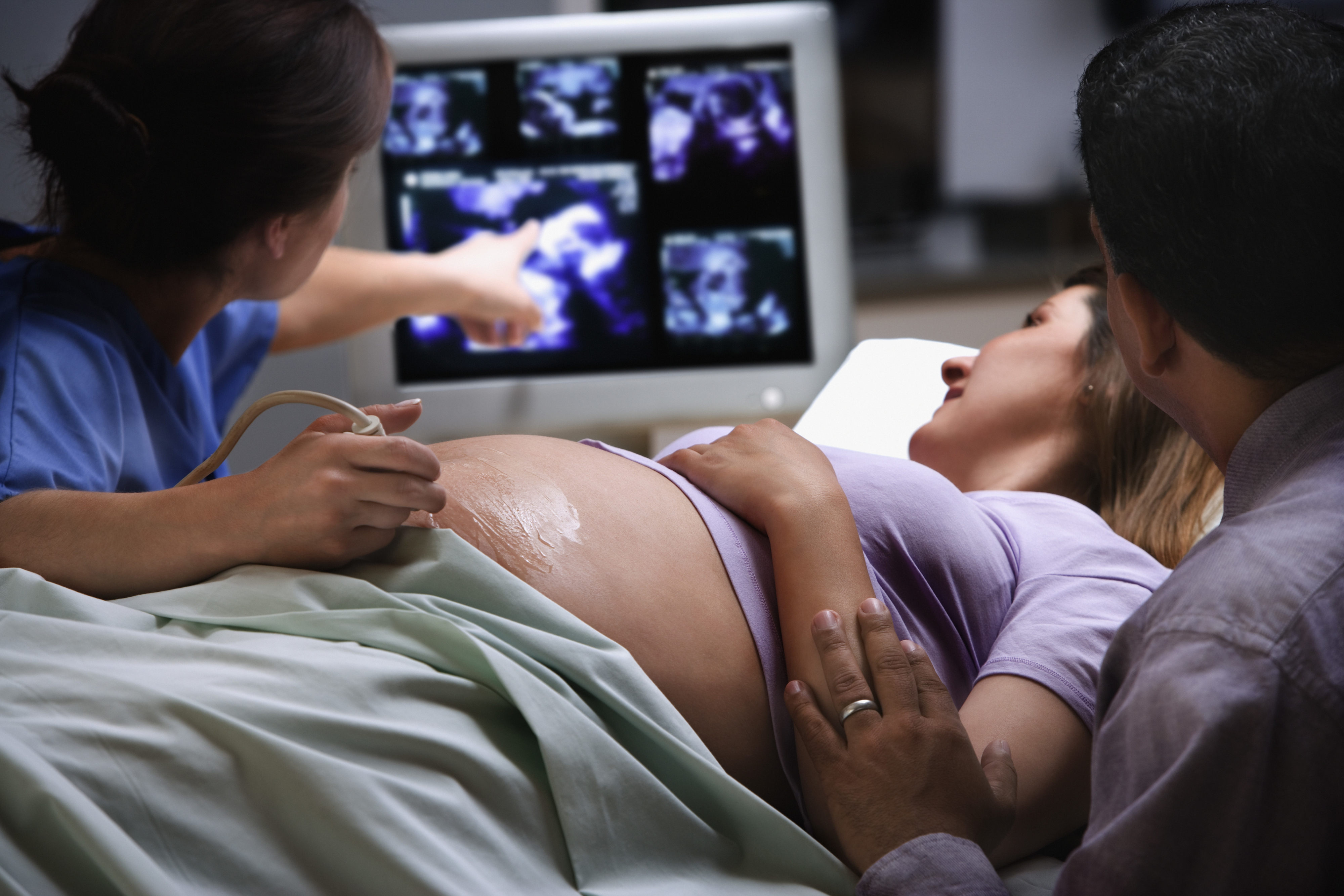 pregnant woman getting an ultrasound scan