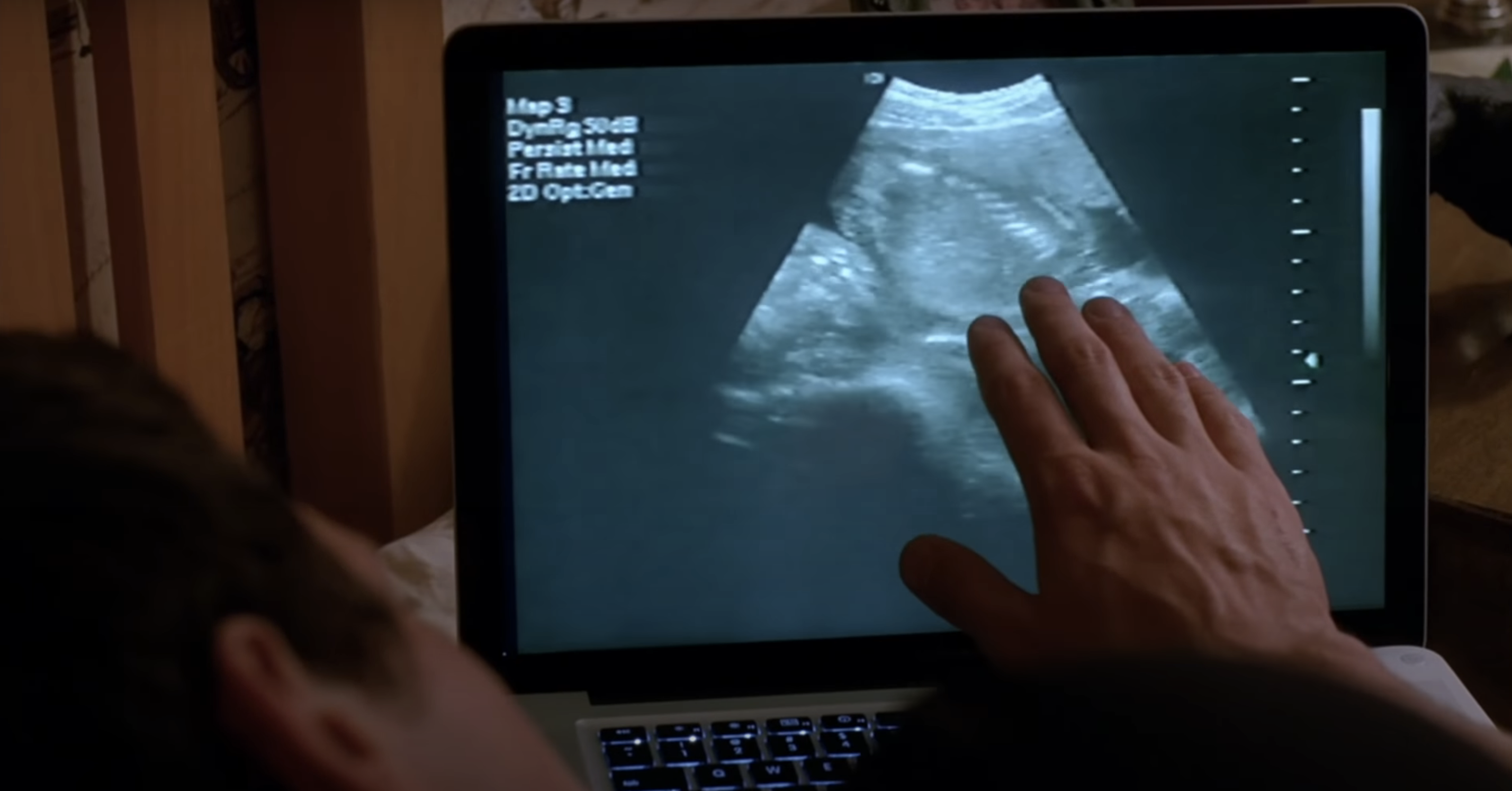 A man touching a sonogram screen