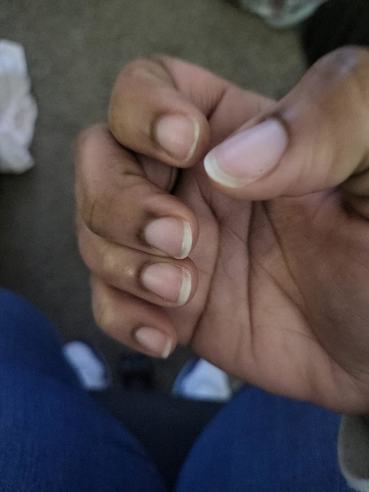 reviewer aft  of close    manus  nails and cuticle