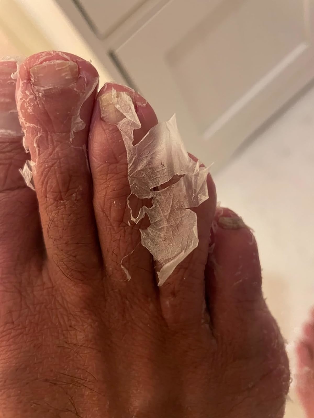 Reviewer showing their foot with the peeling mask