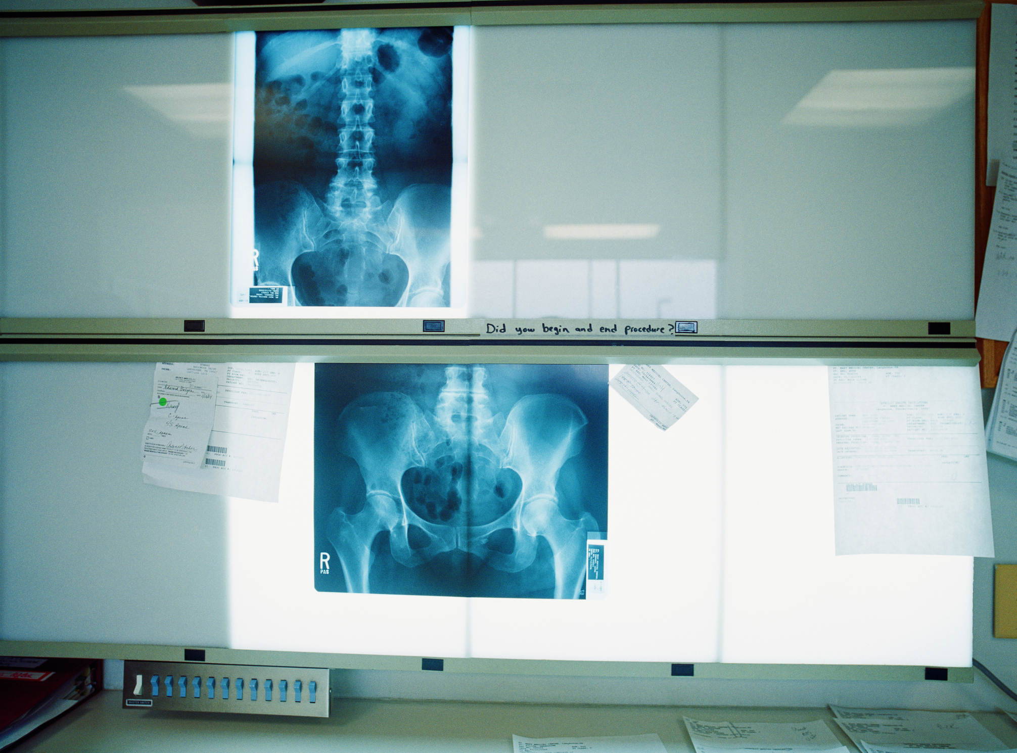 X-rays on an illuminator