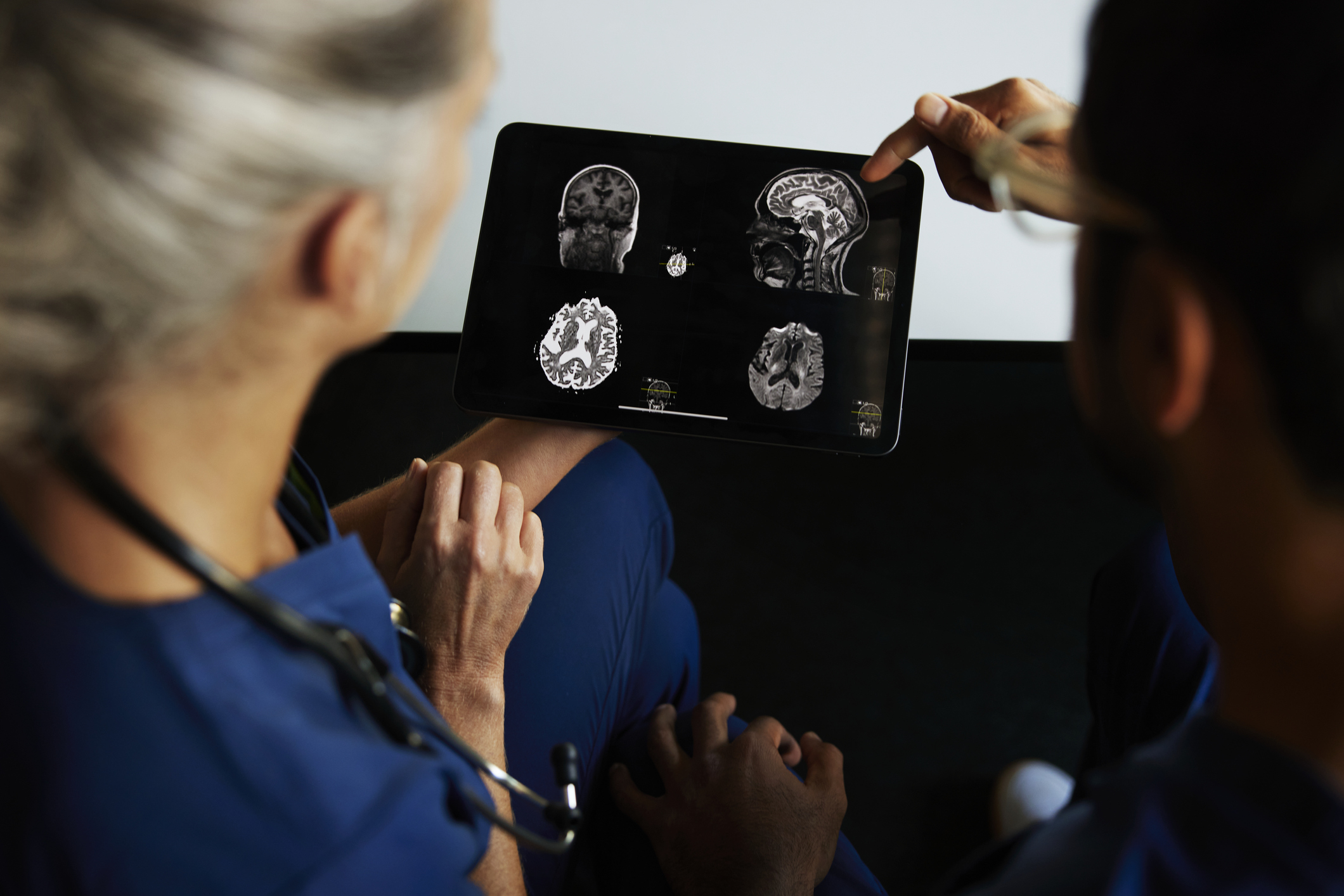 Surgeons looking at brain X-rays on a tablet