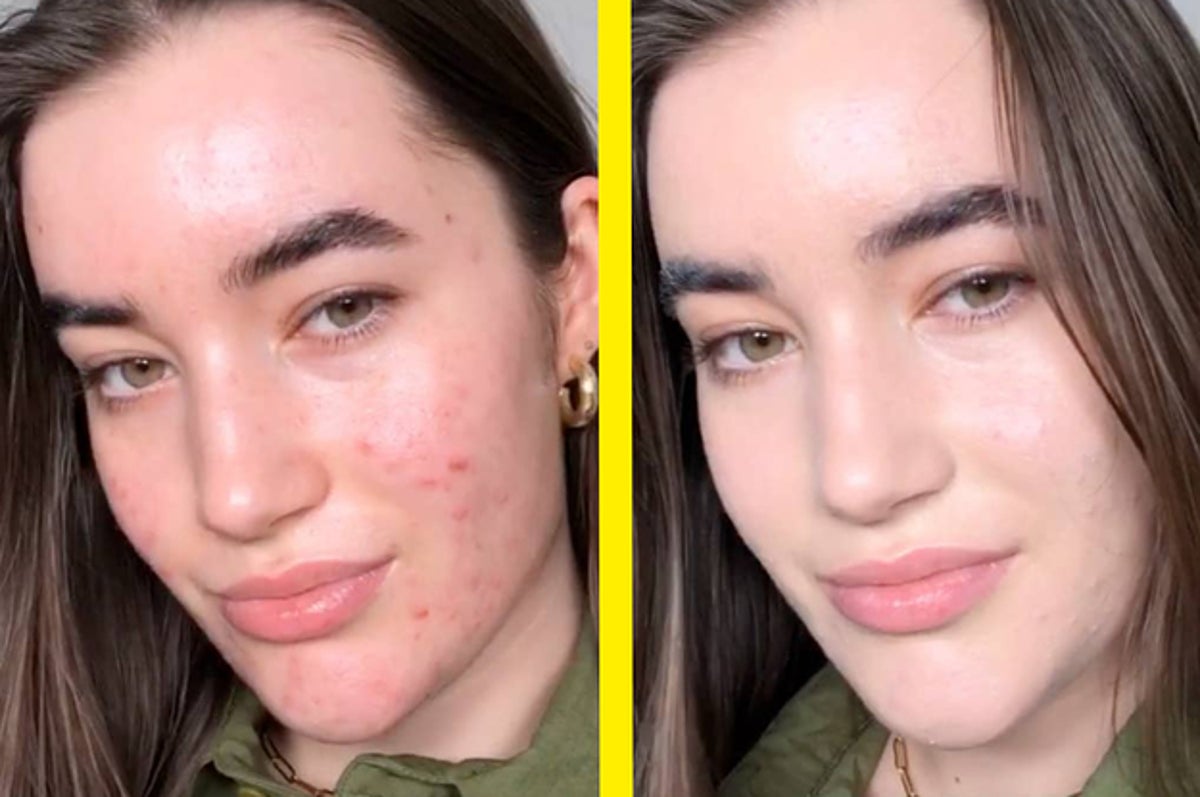 Just 28 Beauty Products With Before And Afters That'll Have You