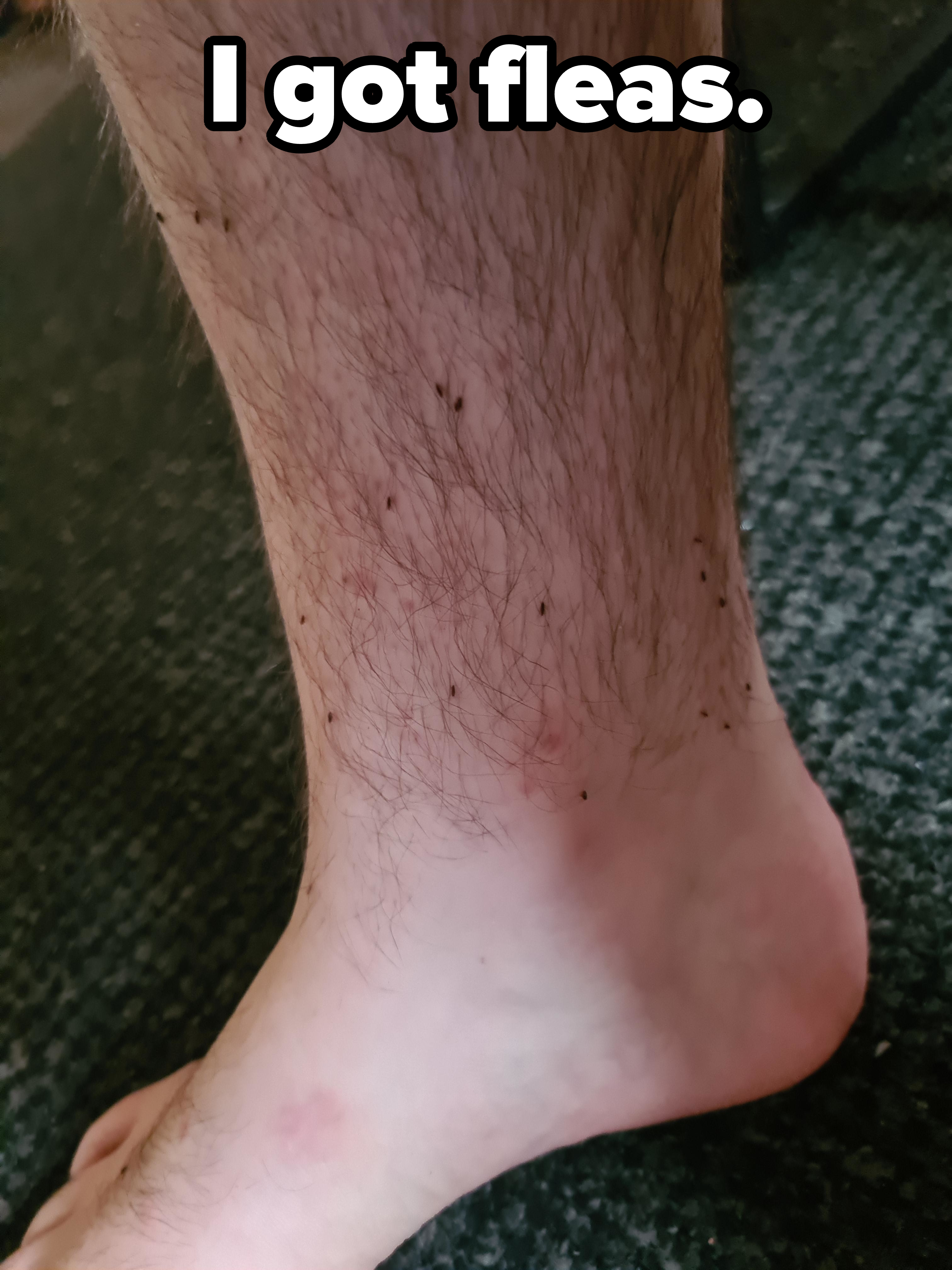 A bare hairy leg with fleas