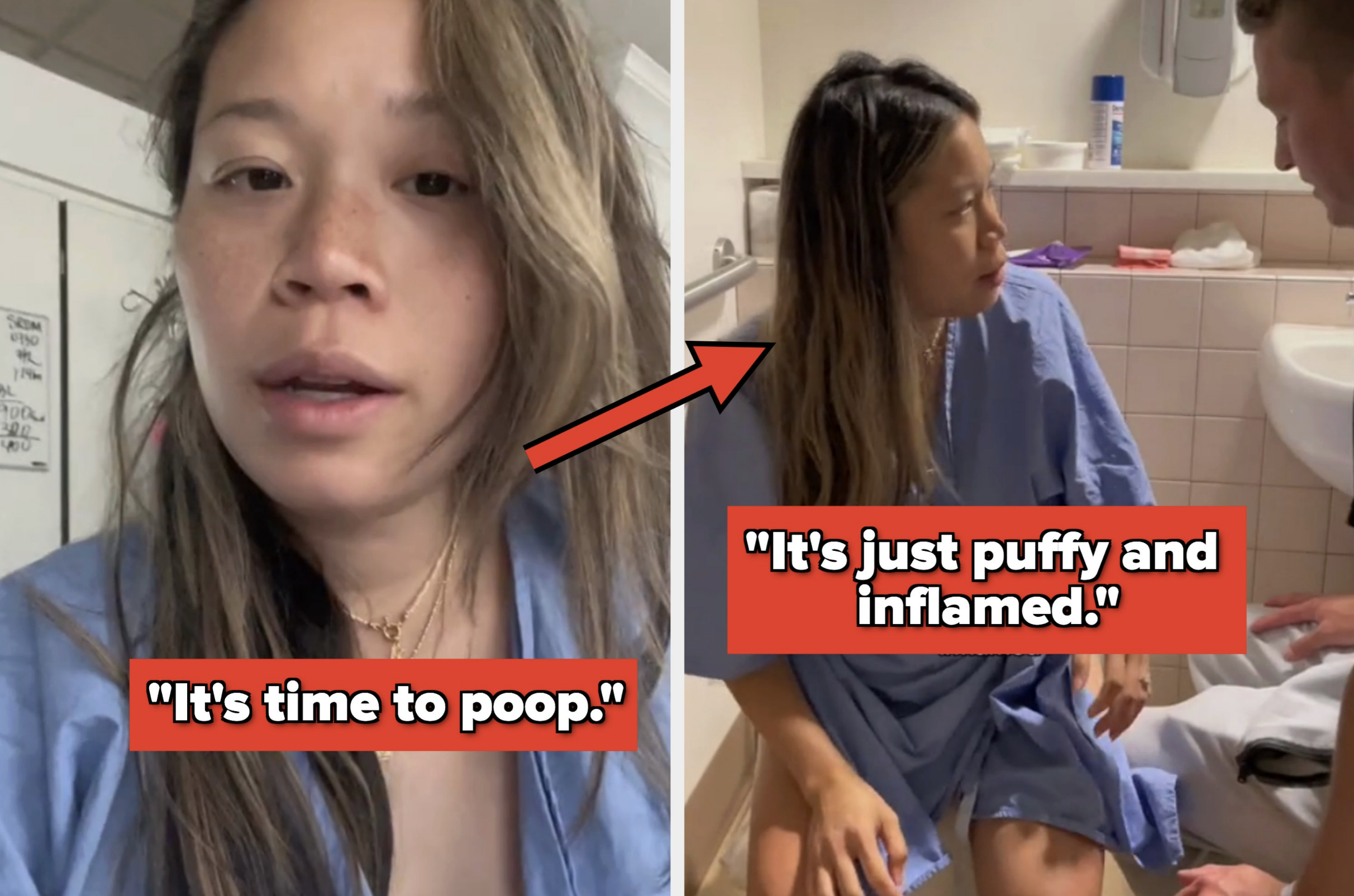 Viral TikTok Exposes Postpartum Pooping Struggle