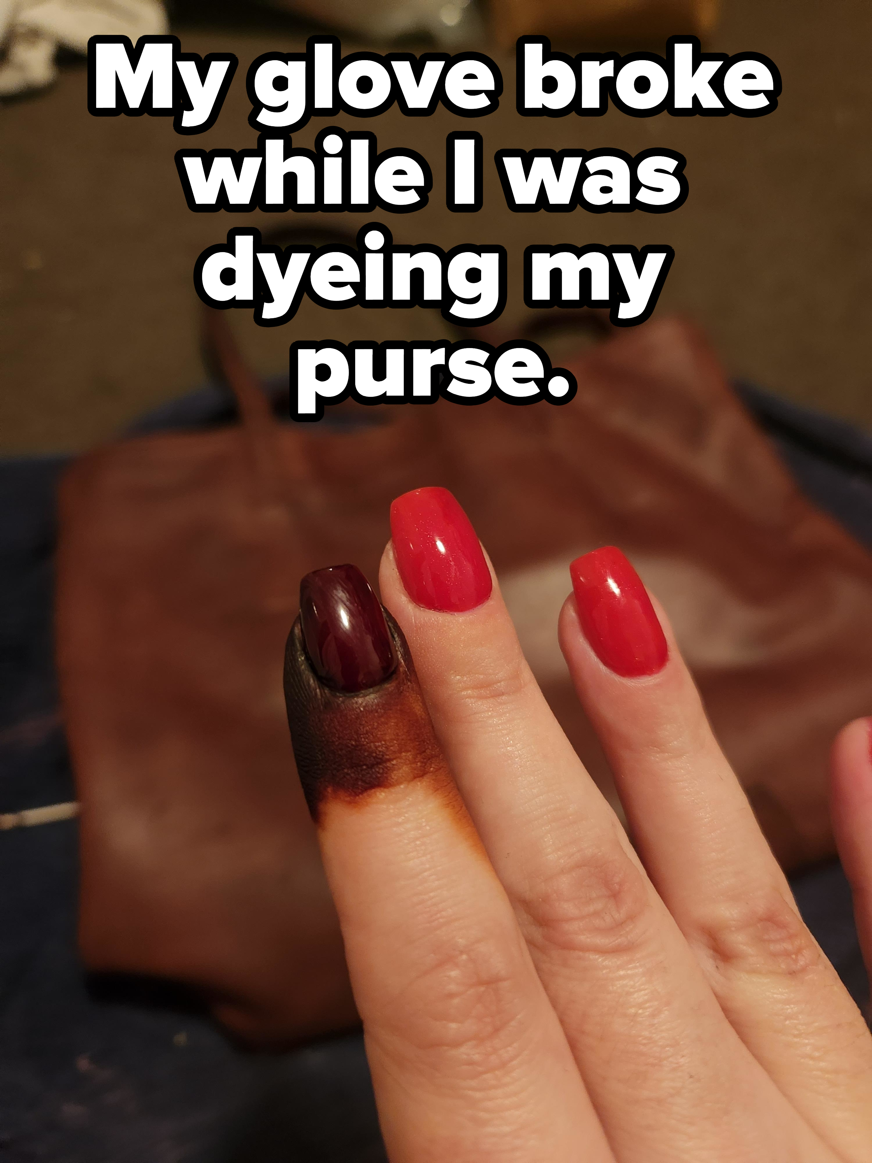 Close-up of a person&#x27;s fingers, one of which is stained dark, with caption &quot;My glove broke while I was dyeing my purse&quot;