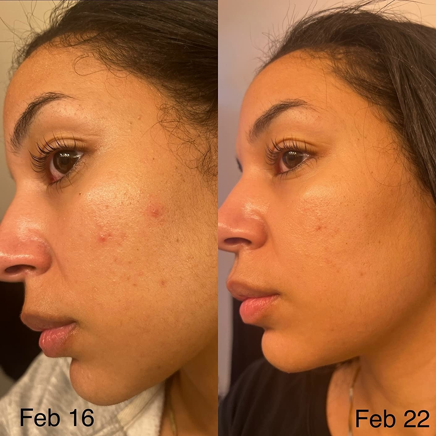 a reviewer shows a before and after of her skin