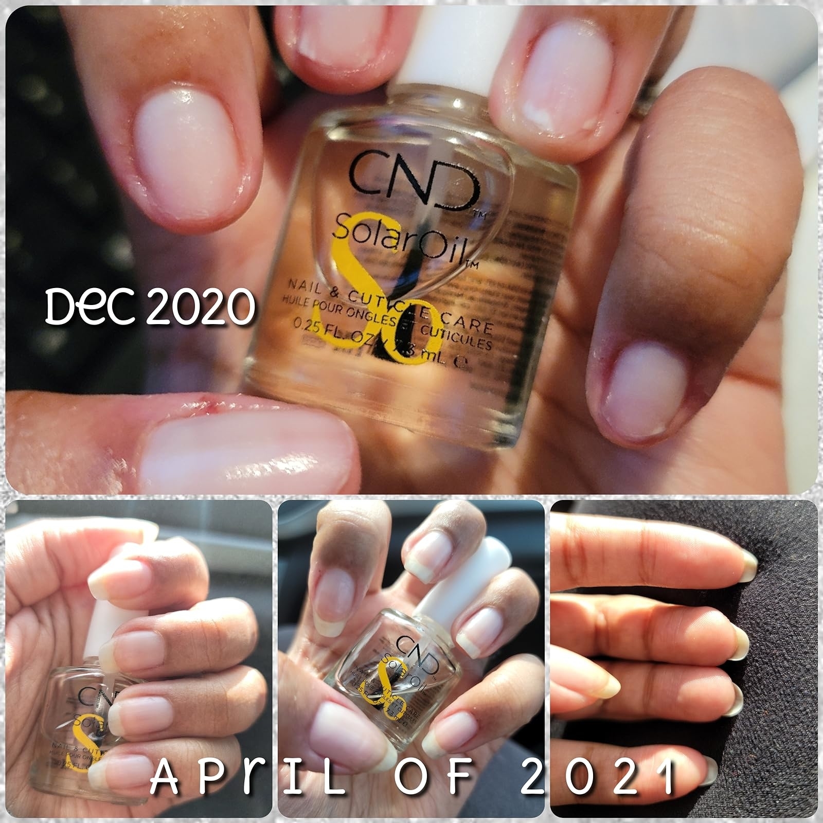 reviewer before and after progress photos of nail growtch