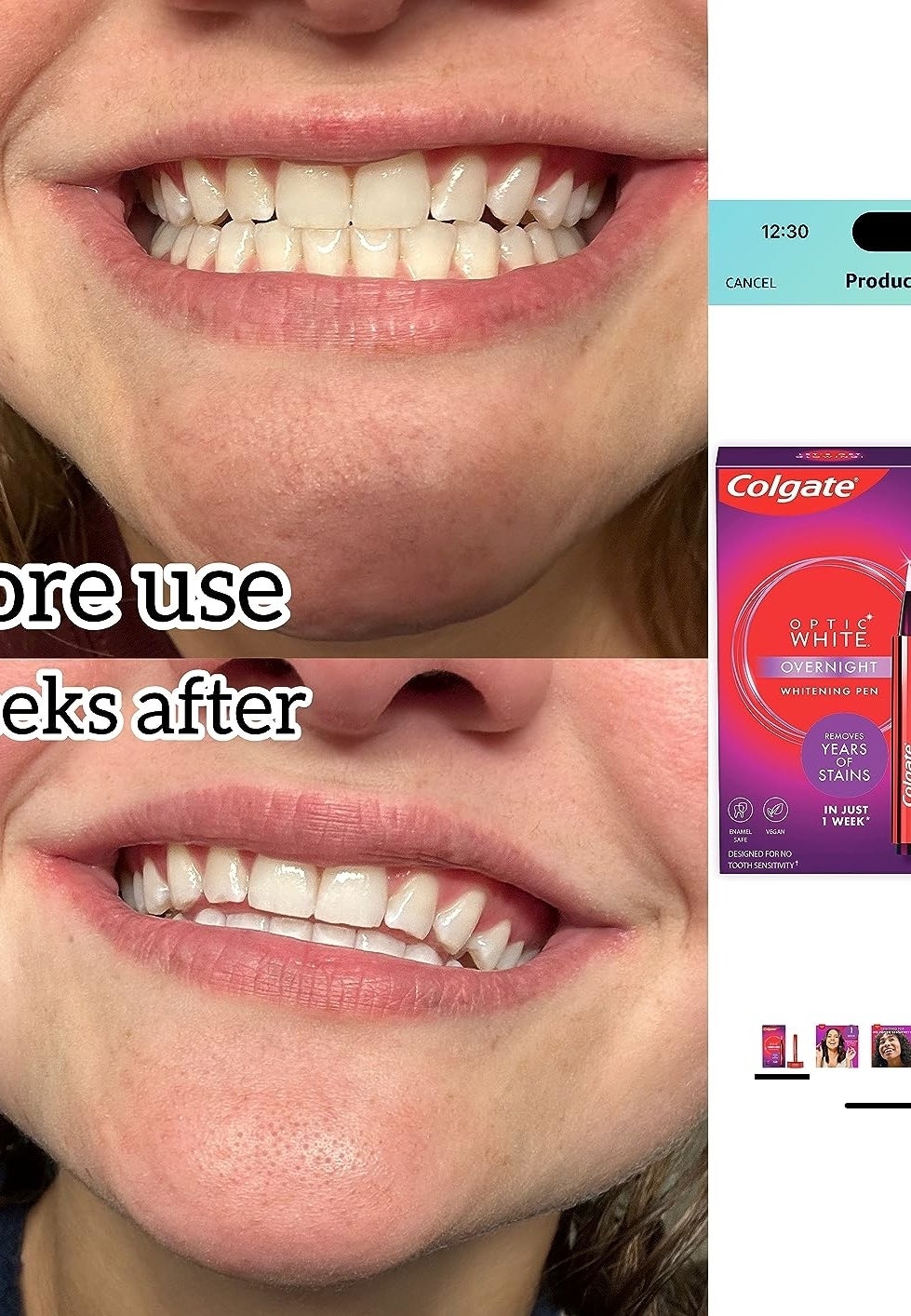 a reviewer&#x27;s teeth before, slightly yellow, and after, looking several shades whiter