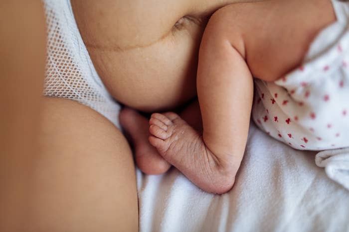 A close-up of mother with visible postpartum body marks in bed with baby